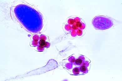 Mikropräparat - Wasserschimmel (Saprolegnia), Schädling an Pflanzen und Tieren