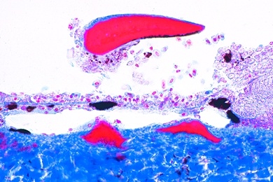 Mikropräparat - Durch Chemieabwässer geschädigte Haut eines Fisches