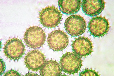 Mikropräparat - Pollenkörner von Laubbäumen