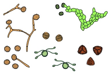 Mikropräparat - Pilzsporen verschiedener Herkunft