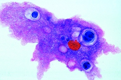 Mikropräparat - Amoeba proteus, Amöben. Zellkern, Ekto- und Endoplasma, Nahrungsvakuolen, Pseudopodien