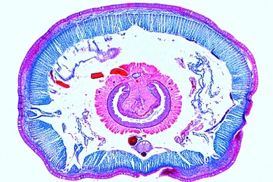 Mikropräparat - Lumbricus, Regenwurm, Körpermitte quer, Typhlosolisregion mit Darm, Nephridien, Hautmuskelschlauch
