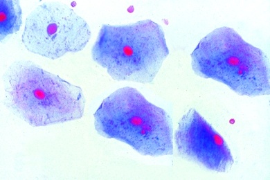 Mikropräparat - Plattenepithel, isolierte Zellen. Zellkerne und Zellplasma