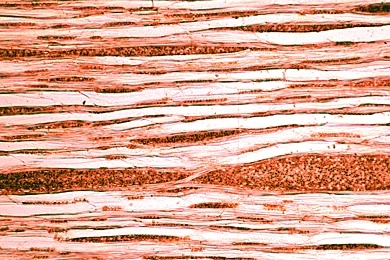 Mikropräparat - Holz der Linde (Tilia), mazeriert, Tracheen, Tracheiden, Holzfasern, Parenchymzellen