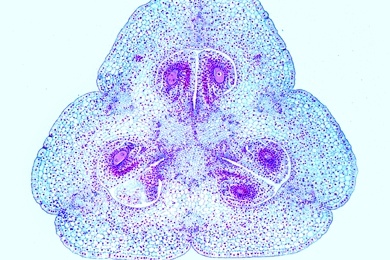 Mikropräparat - Fruchtknoten der Lilie (Lilium candidum), quer, Bau und Anordnung der Samenanlagen, Embryosack