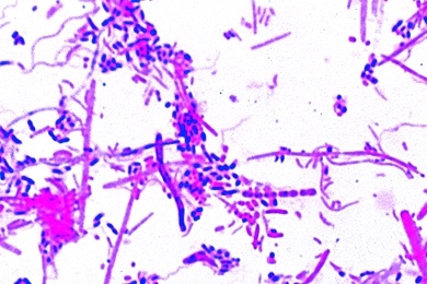 Mikropräparat -Bakterien aus dem Zahnbelag, grampositive und gramnegative Keime