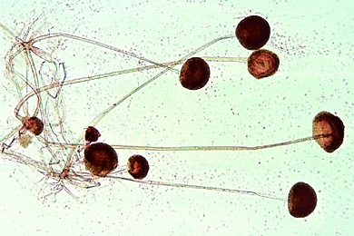 Mikropräparat - Mucor oder Rhizopus, Schimmelpilz, Pilzmyzel und Bildung von Sporangien