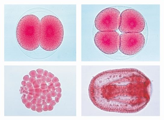 Mikropräparate - Entwicklung des Seeigels (Psammechinus miliaris) 12 Präparate mit Begleittext