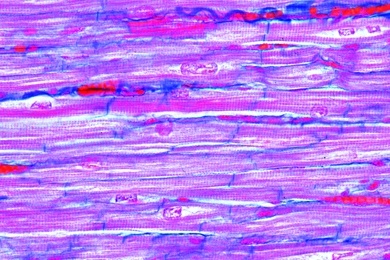 Mikropräparat - Herzmuskel, Mensch, quer und längs, Färbung der Querstreifung