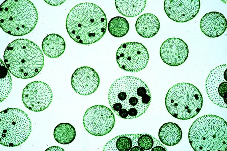 Mikropräparate - Das Leben im Wassertropfen Teil I - Die Kleinlebewelt unserer Gewässer - 25 Präparate mit Begleittext