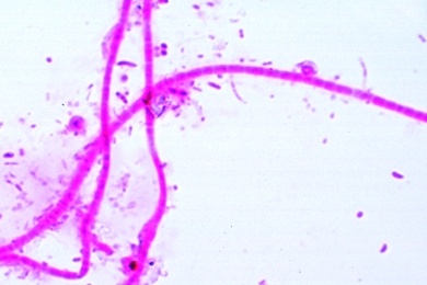 Mikropräparat - Sphaerotilus natans, Abwasserbakterium
