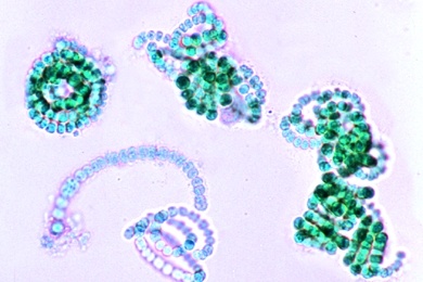 Mikropräparat - Anabaena, fadenförmige Blaualge mit Heterocysten