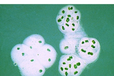 Mikropräparat - Gloeocapsa, Blaualge, kleine Kolonien in Gallerthüllen