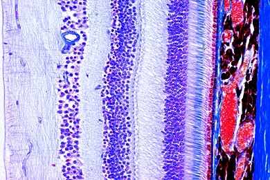 Mikropräparat - Netzhaut (Retina) des Menschen, quer, Feinbau aus Stäbchen und Zapfen