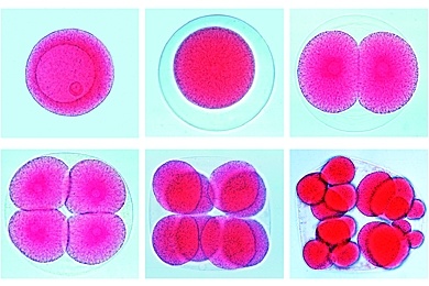 Mikropräparat - Entwicklung des Seeigels, verschiedene Stadien im Streupräparat