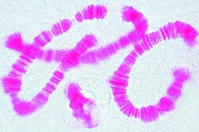 Mikropräparat - Riesenchromosomen in der Speicheldrüse von Chironomus