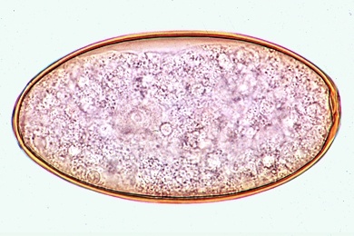 Mikropräparat - Großer Leberegel, Fasciola hepatica, Eier aus dem Gallensediment