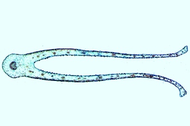 Mikropräparat - Urnenblatt der Kannenpflanze (Nepenthes) mit Verdauungsdrüsen, quer. Insektenfalle