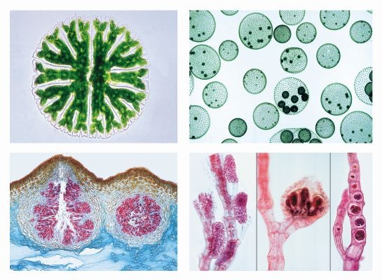 Mikropräparate in Serie - Algen (Algae), 30 Präparate mit Begleittext