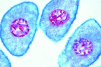 Mikropräparat - Lilie, Einkernige (haploide) Mikrosporen nach erfolgter Trennung der Tetradenzellen