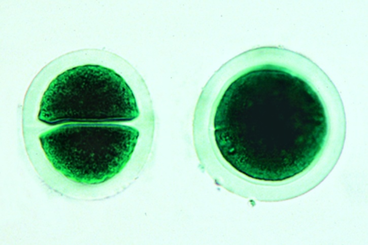 Mikropräparat - Chroococcus, einzellige Blaualgen