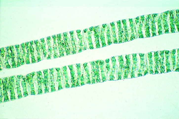 Mikropräparat - Spirogyra, vegetativ, große Form mit mehreren Chloroplasten in jeder Zelle