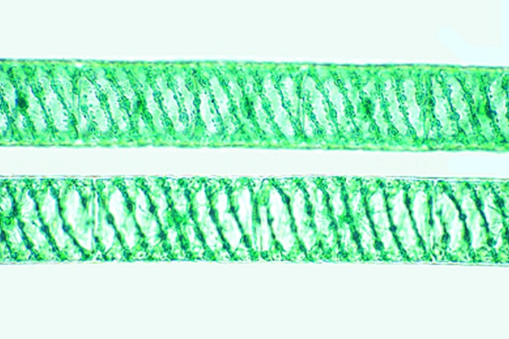 Mikropräparat - Spirogyra, Schraubenalge, spiralförmiger Chloroplast, vegetativ