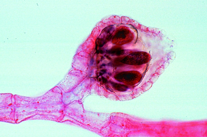 Mikropräparat - Polysiphonia oder Rhodomela, Zystokarp