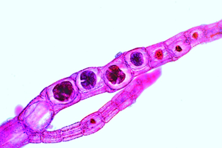 Mikropräparat - Polysiphonia oder Rhodomela, Tetrasporen
