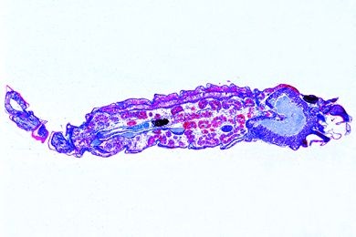 Mikropräparat - Scorpion, junges Tier sagittal längs