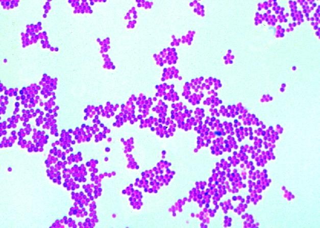 Mikropräparat - Staphylococcus aureus, Eitererreger, Ausstrich von Kultur