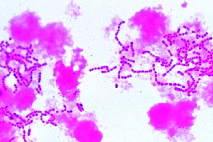 Mikropräparat - Streptococcus pyogenes. Eitererreger. Eiterausstrich mit langen Ketten