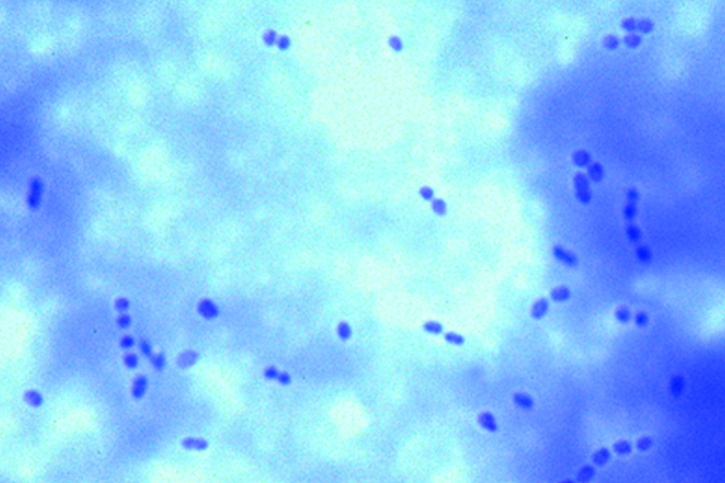 Mikropräparat - Streptococcus lactis. Milchsäurebildner. Milchausstrich mit kurz