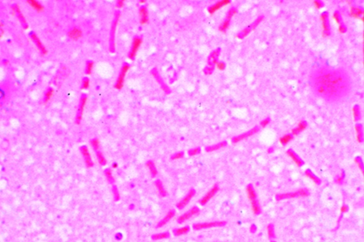 Mikropräparat - Bacillus anthracis. Milzbranderreger. Olts Kapselfärbung