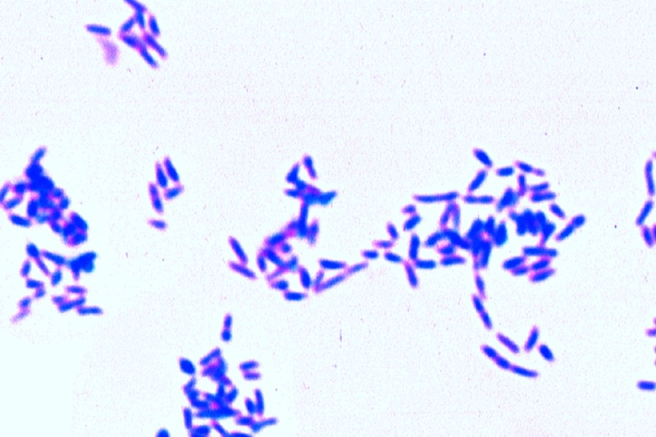 Mikropräparat - Corynebacterium diphtheriae. Diphtherie. Ausstrich