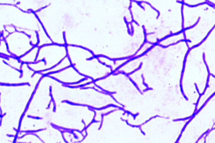 Mikropräparat - Streptomyces griseus. Antibioticum Streptomycin. Ausstrich