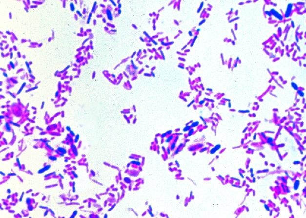 Mikropräparat - Bakterienflora aus dem menschlichen Darm. Ausstrich