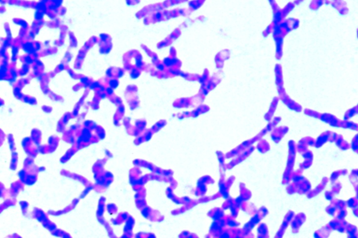Mikropräparat - Kernfärbung (Bacillus cereus), Ausstrich speziell gefärbt für Kernsubstanz, Feulgen