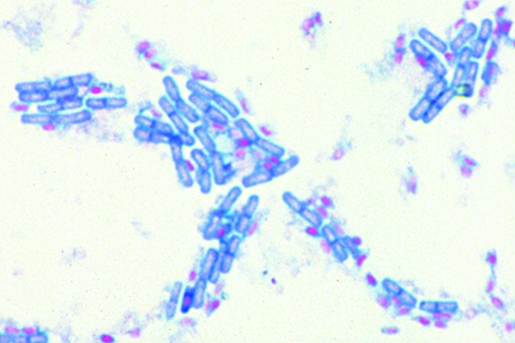 Mikropräparat - Sporenfärbung (Bacillus subtilis) mit zentral gelegenen Sporen.
