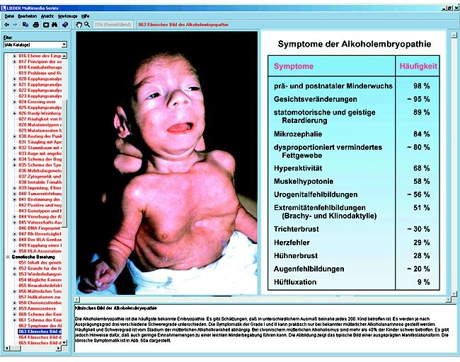 Embryologie und Entwicklung, Interaktive CD-ROM