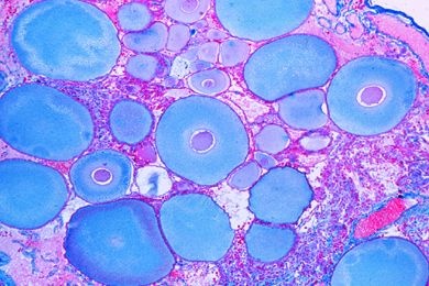 Mikropräparat - Astacus, Ovarium mit Eientwicklung in verschiedenen Stadien