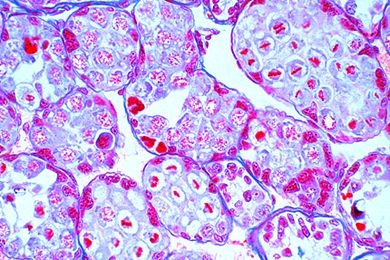 Mikropräparat - Astacus, Hoden mit Spermiogenese, quer