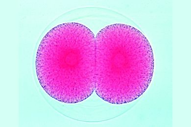 Mikropräparat - Psammechinus, Zwei-Zellen-Stadium