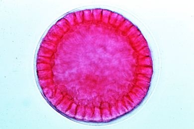 Mikropräparat - Psammechinus, Blastula