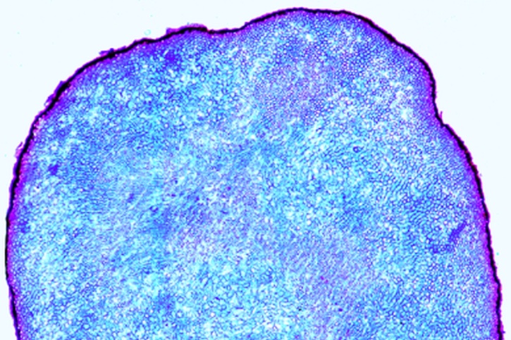Mikropräparat - Claviceps purpurea, Mutterkorn, Sklerotium quer