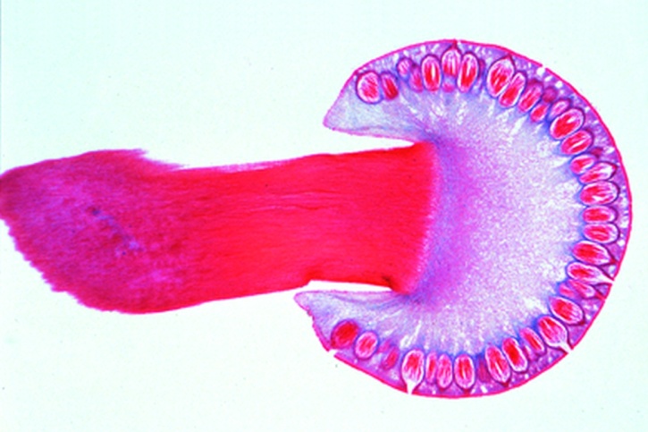 Mikropräparat - Claviceps purpurea, Stroma mit Perithezien und Asci längs