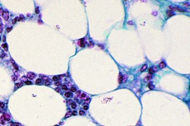 Mikropräparat - Fettgewebe des Menschen, Fett entfernt, Färbung der Zellen, Schnitt