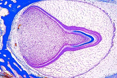 Mikropräparat - Zahnanlage vom Foetus, mittleres Stadium
