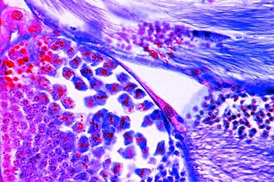 Mikropräparat - Heuschrecke, Hoden, quer. Spermatogenese mit zahlreichen Meiose- und Mitose-Stadien