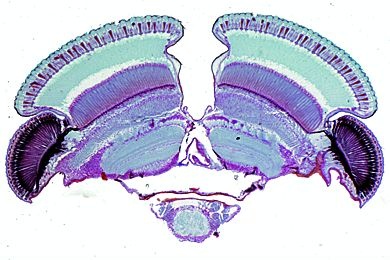 Mikropräparat - Cloeon oder Baetis, Eintagsfliege, Querschnitt durch den Kopf mit Turbanaugen